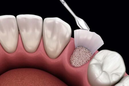 7 Different Types of Oral Surgery Procedures - Hampton Village Dentistry