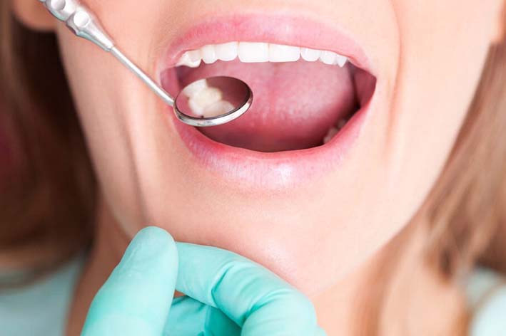 Oral Biopsies